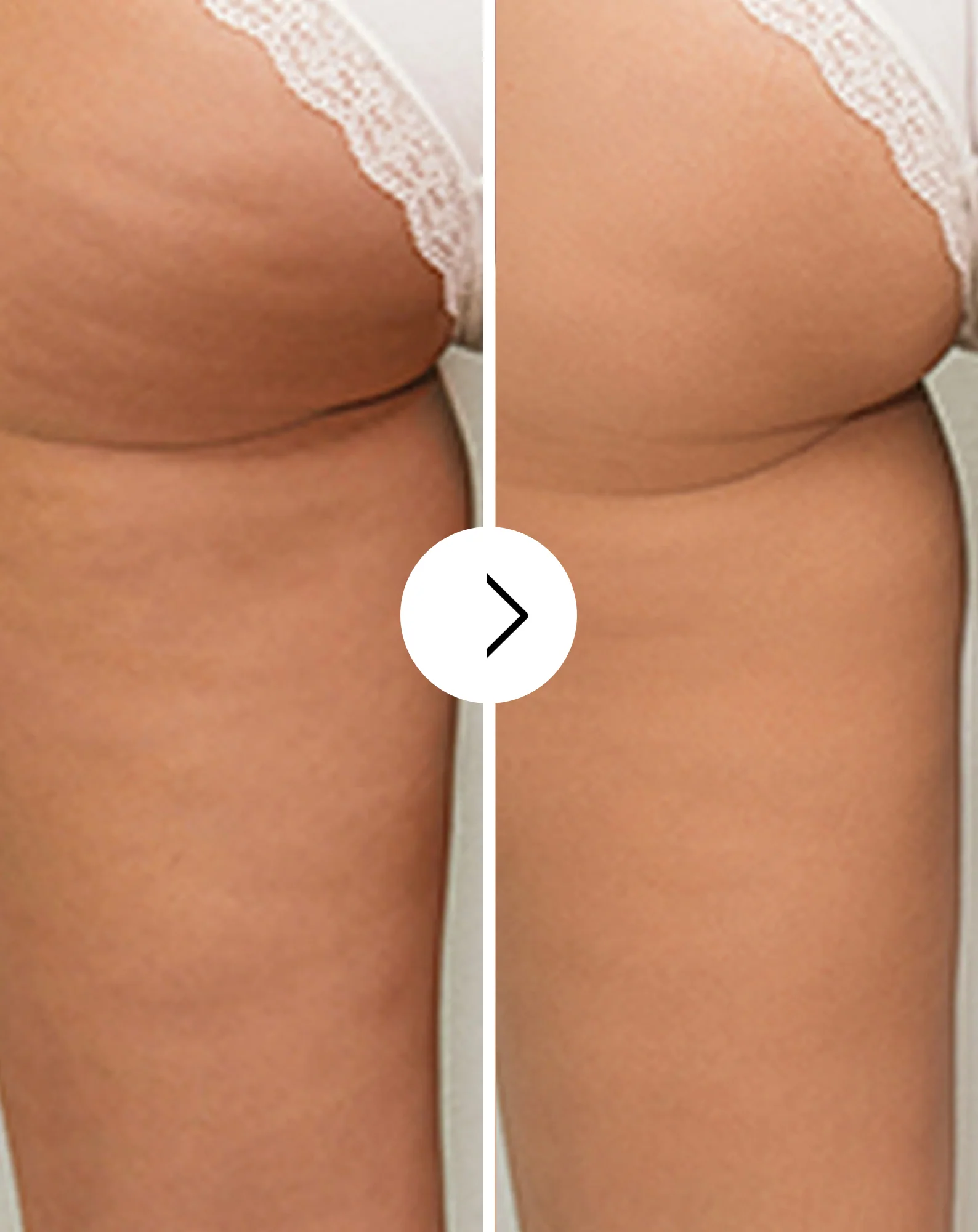 Comprimés de traitement anti-cellulite et pour améliorer les qualités de la peau aux extraits naturels Cellinea 60 gélules - Image 2