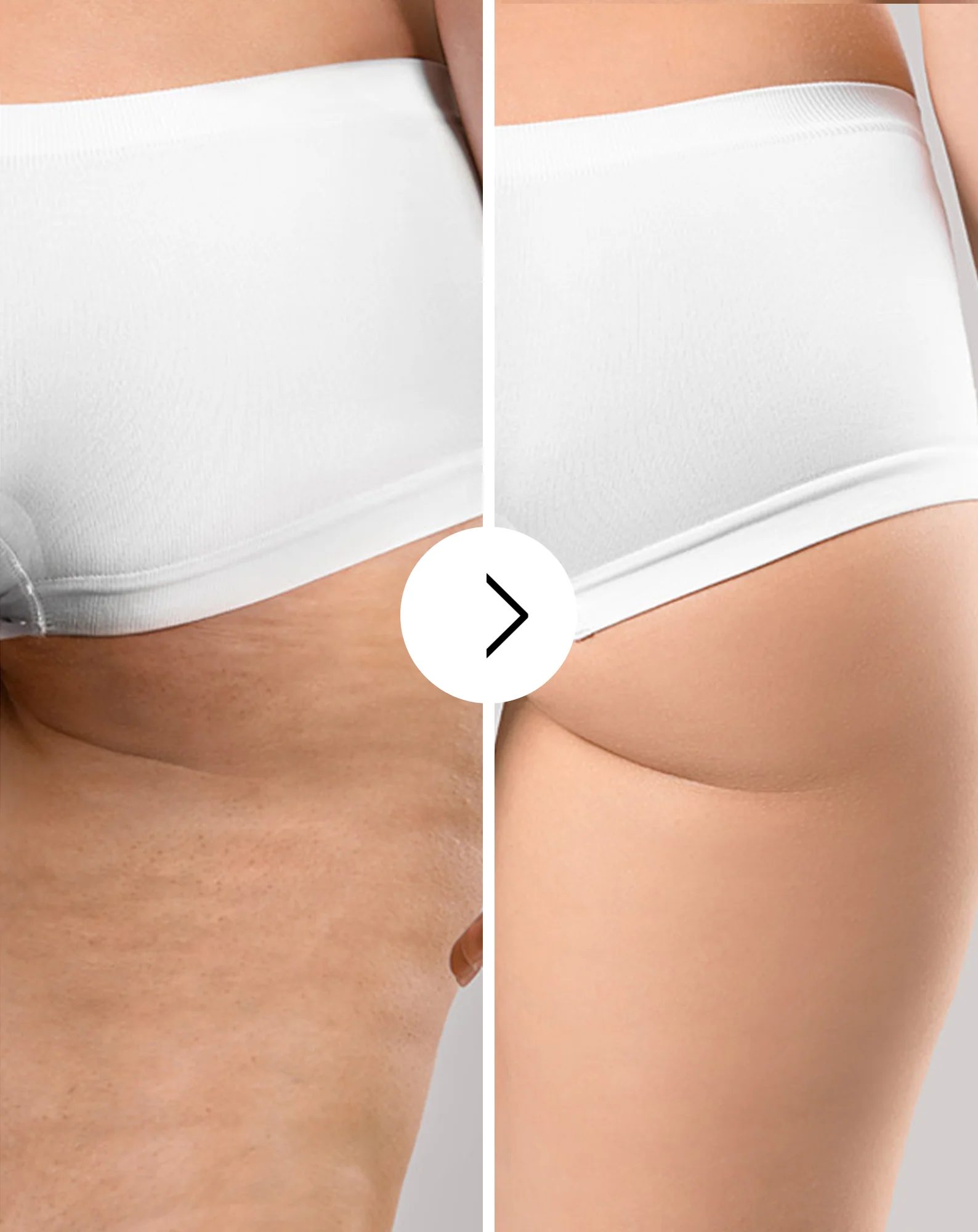 Comprimés de traitement anti-cellulite et pour améliorer les qualités de la peau aux extraits naturels Cellinea 60 gélules - Image 3