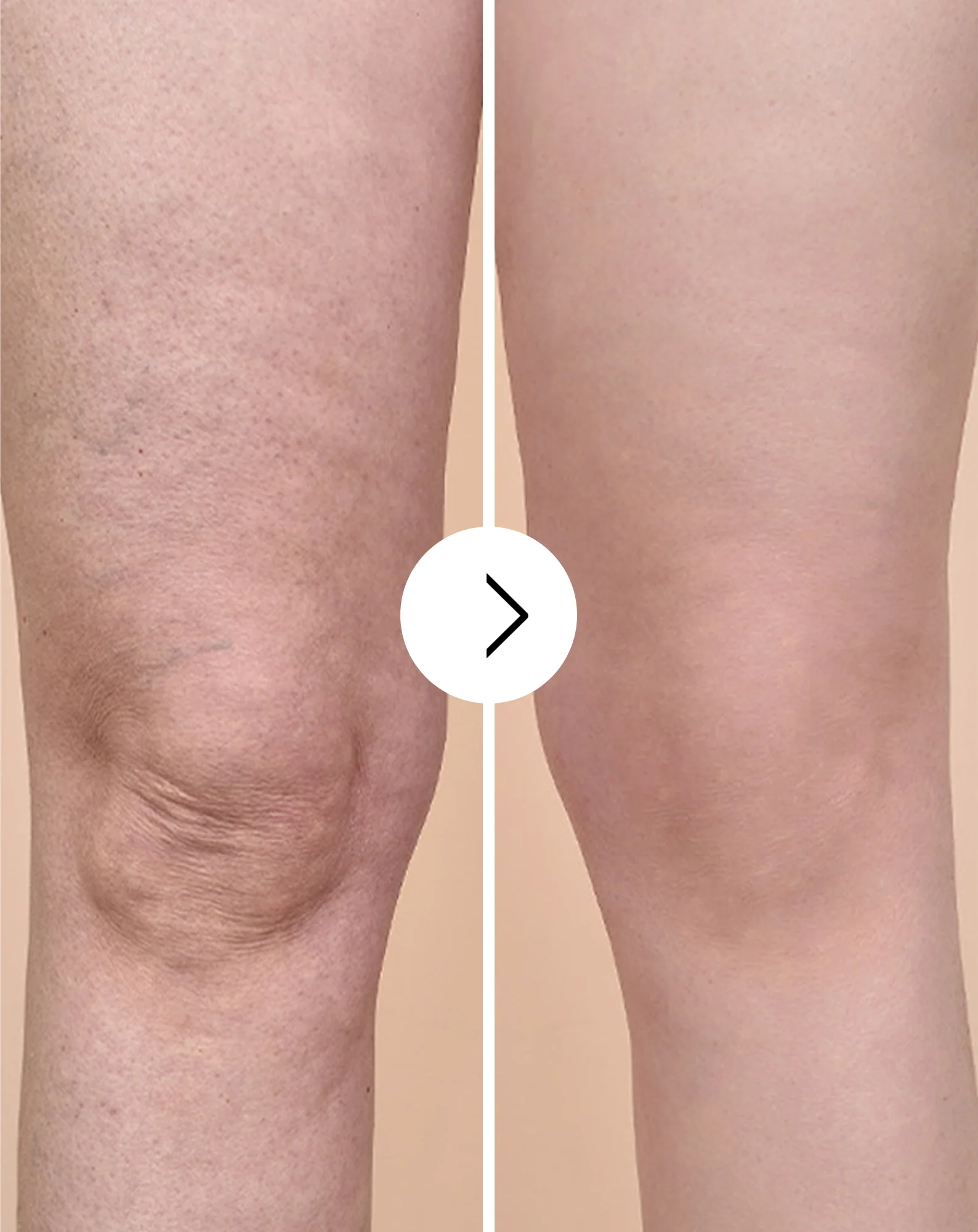 Comprimés de traitement anti-cellulite et pour améliorer les qualités de la peau aux extraits naturels Cellinea 60 gélules - Image 4