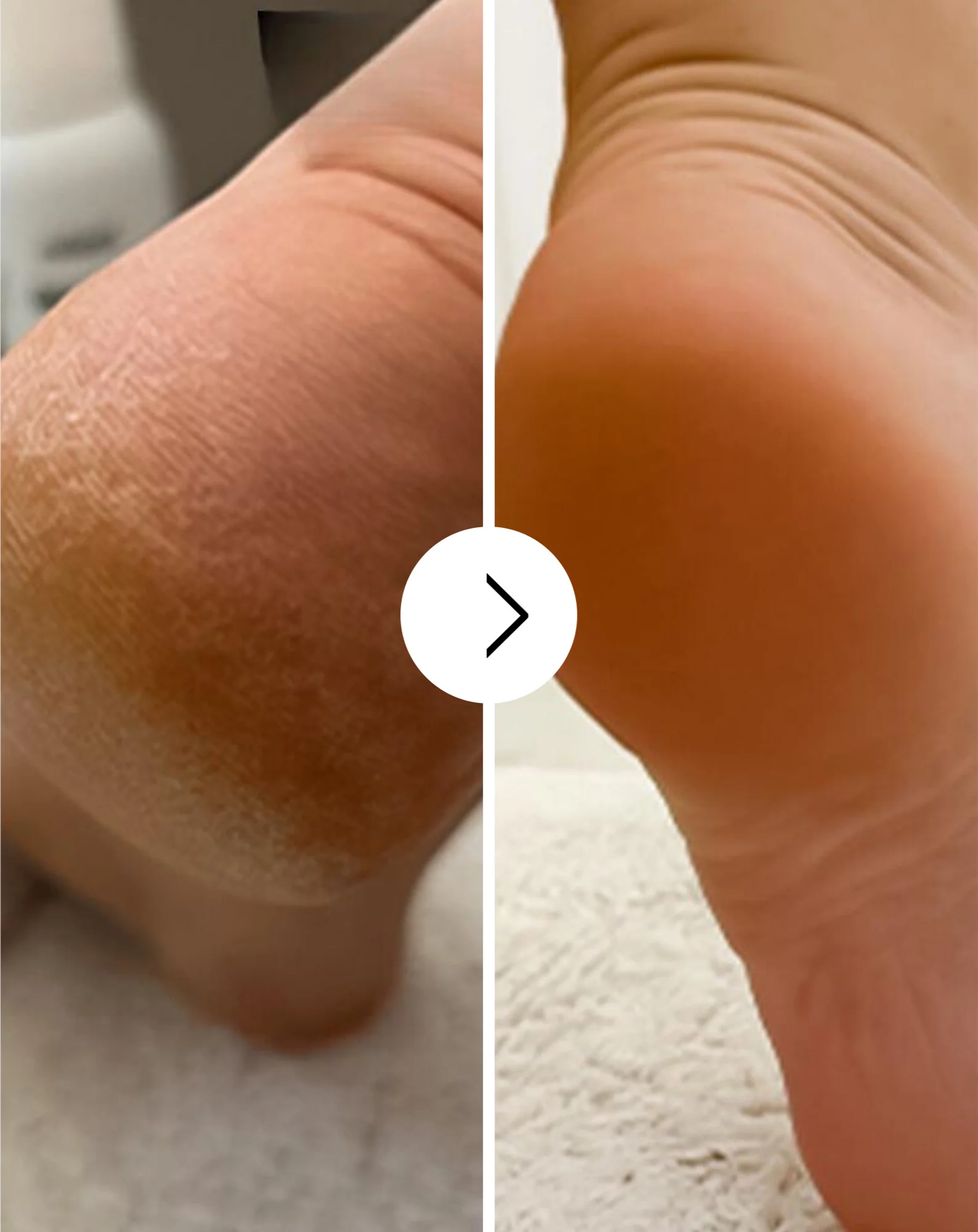 Crème adoucissante pour les pieds Nutridome à l'urée et au beurre de karité - Image 4