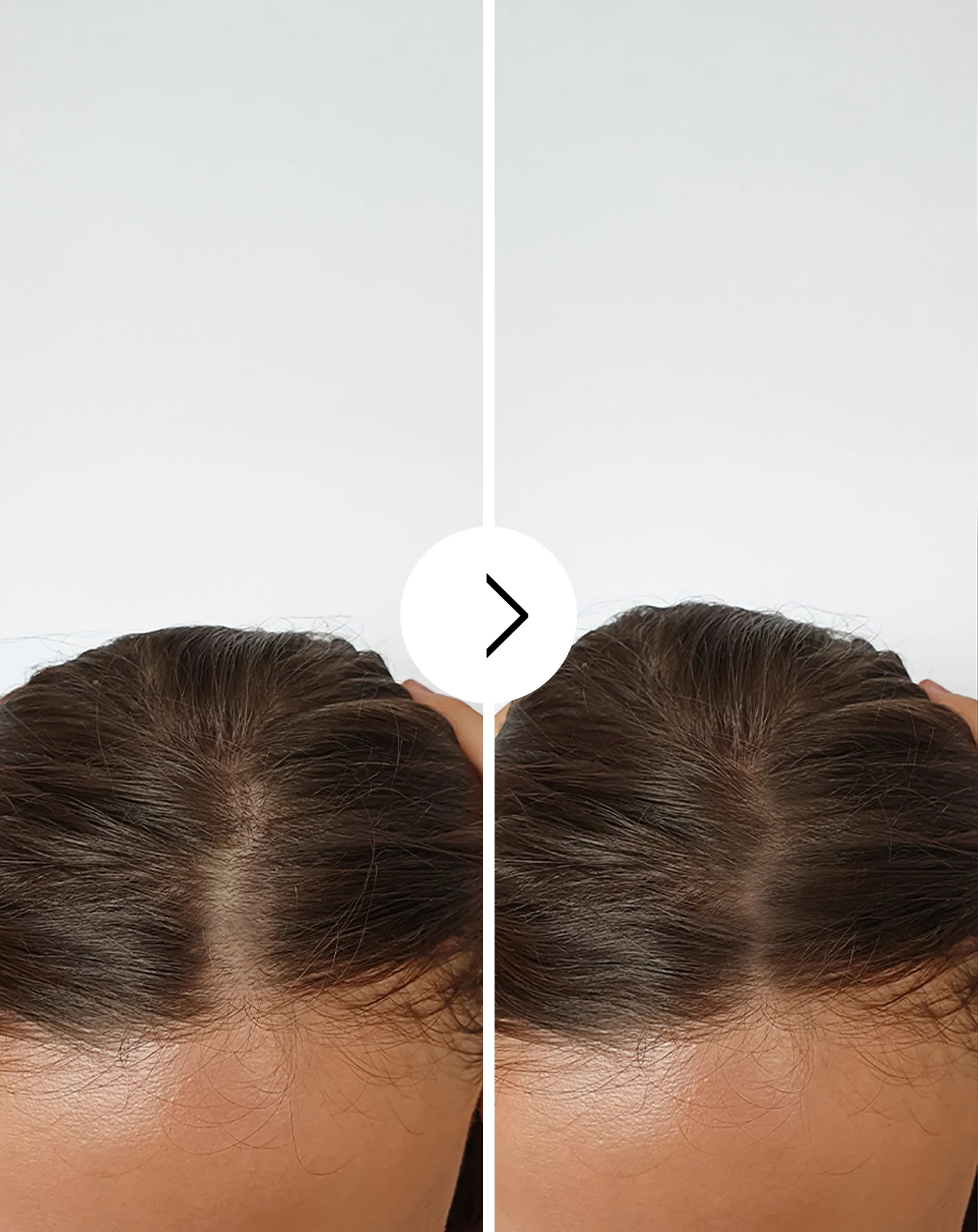 Gélules contre la chute des cheveux à effet épaississant et fortifiant Follixin 60 gélules - Image 4
