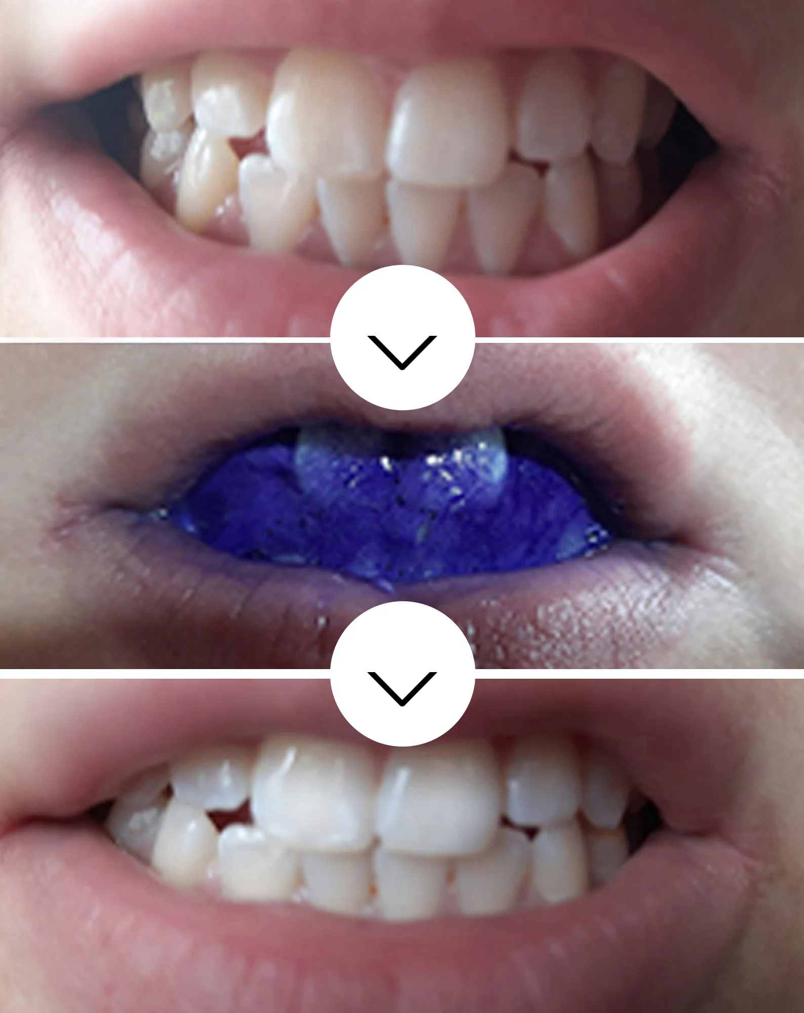 Smilebite White Bite Color Corrector - Sérum correcteur de couleur des dents 30 ml - Image 3